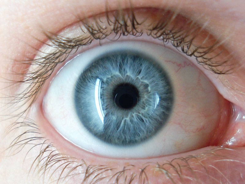 Cosmetic Eye Surgery Turns Brown Eyes Into Blue